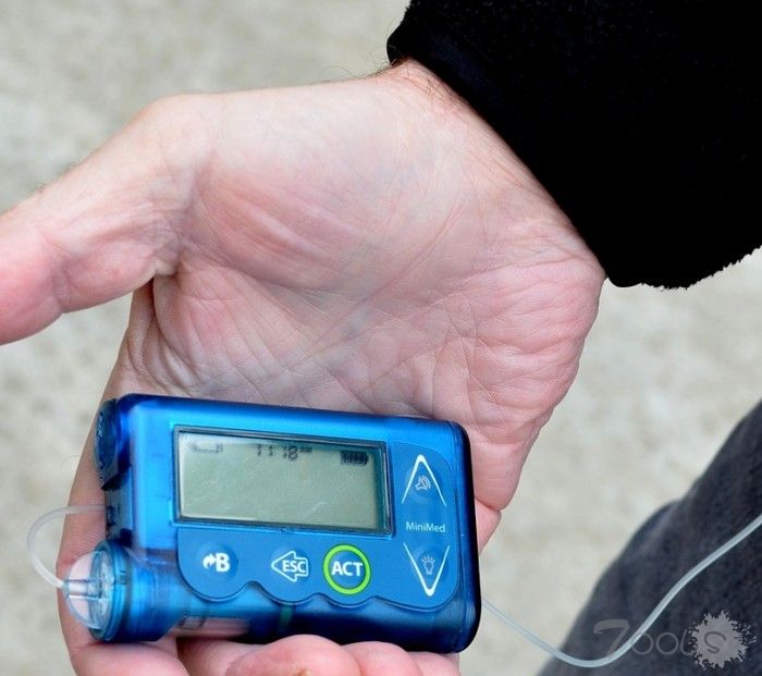 FDA警告黑客攻击风险 美敦力宣布召回MiniMed胰岛素泵