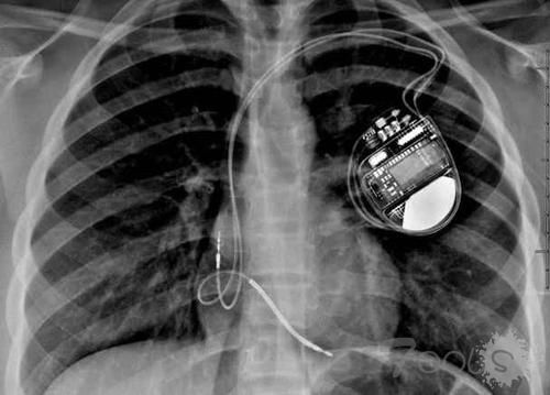 他才是真正的“黑客”？不仅破解ATM无限吐钱、还能入侵心脏起搏器！